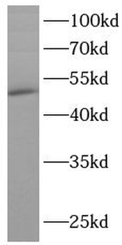 TARDBP Rabbit Polyclonal Antibody