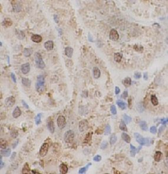TARDBP Rabbit Polyclonal Antibody