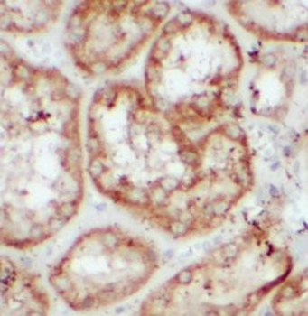 SLC4A4 Rabbit Polyclonal Antibody