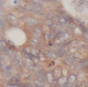 CYP27A1 Antibody