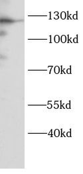 DNA2 Rabbit Polyclonal Antibody