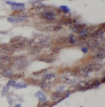 DNA2 Rabbit Polyclonal Antibody