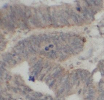 MAP3K1 Rabbit Polyclonal Antibody
