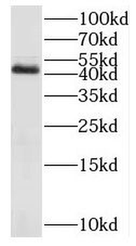 MAP2K4 Rabbit Polyclonal Antibody