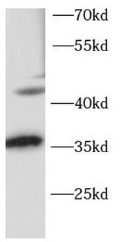 OTX2 Rabbit Polyclonal Antibody