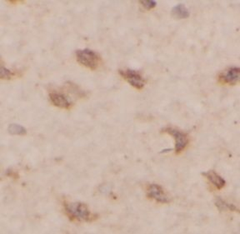OTX2 Rabbit Polyclonal Antibody