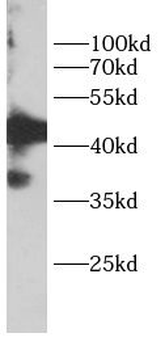 PIM1 Rabbit Polyclonal Antibody