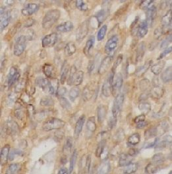 PIM1 Rabbit Polyclonal Antibody