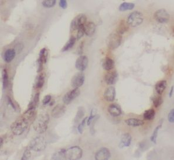 PTGER3 Rabbit Polyclonal Antibody