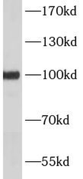 PCDH15 Rabbit Polyclonal Antibody