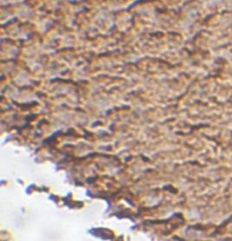 PCDH15 Rabbit Polyclonal Antibody