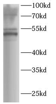 CHIA Rabbit Polyclonal Antibody