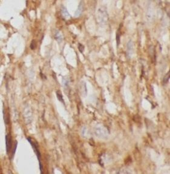 CHIA Rabbit Polyclonal Antibody