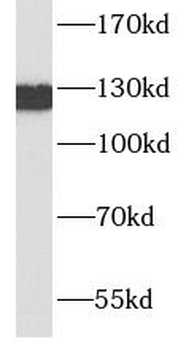 CDH1 Mouse Monoclonal Antibody