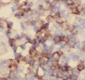 CD100 Mouse Monoclonal Antibody