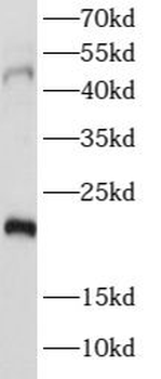 PTGER4 Rabbit Polyclonal Antibody