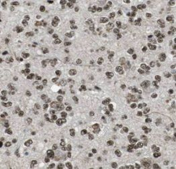 PLCB1 Rabbit Polyclonal Antibody