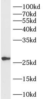 RAB33B Rabbit Polyclonal Antibody