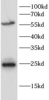 PPARD Rabbit Polyclonal Antibody