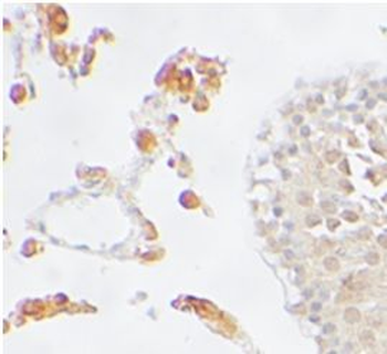 PPARD Rabbit Polyclonal Antibody