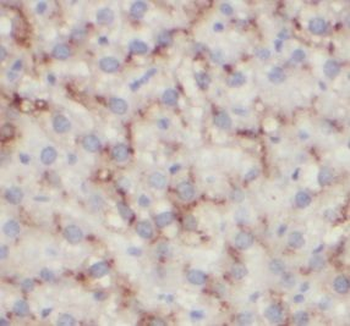 FCGR3A Antibody