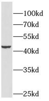 GSDMB Rabbit Polyclonal Antibody