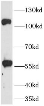 TLR8 Rabbit Polyclonal Antibody