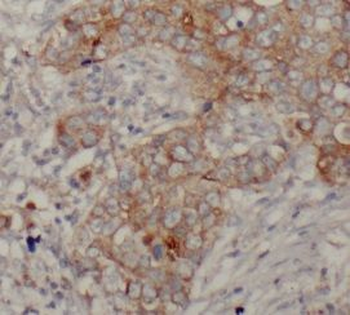 TLR8 Rabbit Polyclonal Antibody