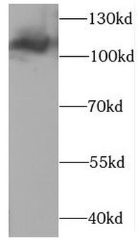 CLCN1 Rabbit Polyclonal Antibody