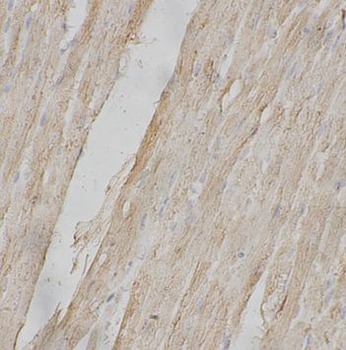 CLCN1 Rabbit Polyclonal Antibody