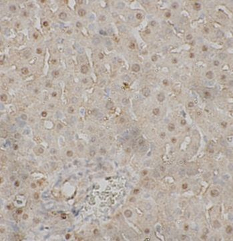 C8B Rabbit Polyclonal Antibody