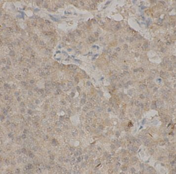 TEAD1 Rabbit Polyclonal Antibody