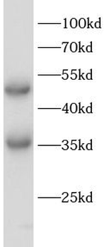 EGLN1 Rabbit Polyclonal Antibody