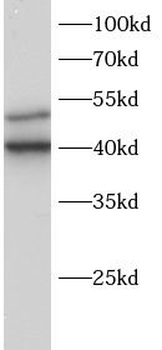 SLA Rabbit Polyclonal Antibody