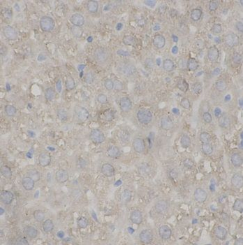 ANGPTL8 Rabbit Polyclonal Antibody