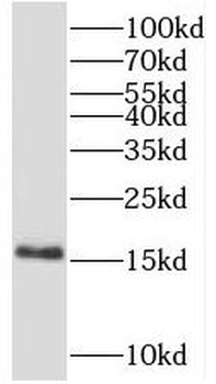 LAMTOR1 Rabbit Polyclonal Antibody