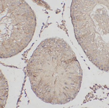 LAMTOR1 Rabbit Polyclonal Antibody