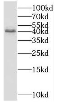 FUCA2 Rabbit Polyclonal Antibody