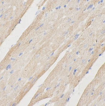 FUCA2 Rabbit Polyclonal Antibody