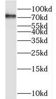 RIPK1 Rabbit Polyclonal Antibody