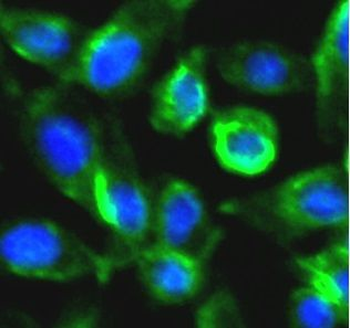 RIPK1 Rabbit Polyclonal Antibody