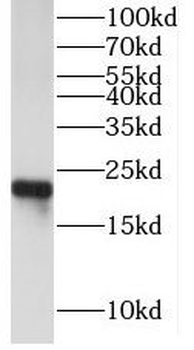CYGB Rabbit Polyclonal Antibody