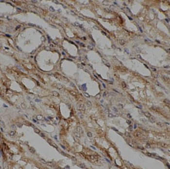 CYGB Rabbit Polyclonal Antibody