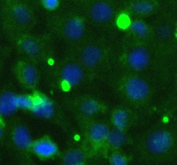TRAM1 Rabbit Polyclonal Antibody