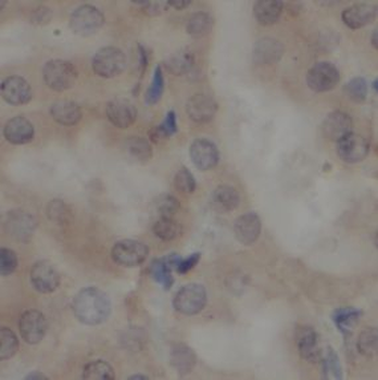 SHARPIN Antibody