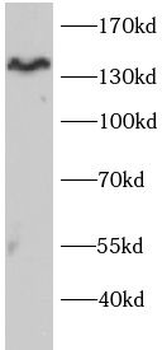 INPPL1 Rabbit Polyclonal Antibody