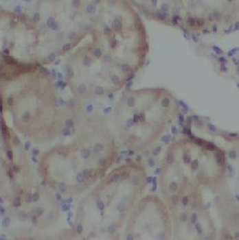 INPPL1 Rabbit Polyclonal Antibody