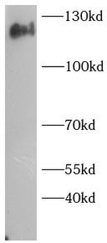 RNF216 Rabbit Polyclonal Antibody