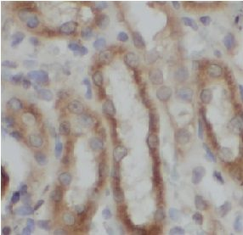 RNF216 Rabbit Polyclonal Antibody