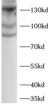 ERC1 Rabbit Polyclonal Antibody